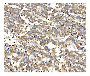 Anti-PI3K-gamma/PIK3CG Antibody