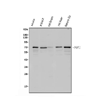 Anti-POT1 Antibody