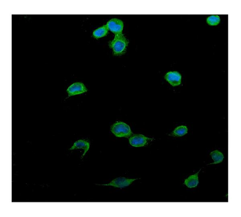 PTCH2 Antibody