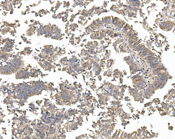 Anti-PTCH2 Antibody