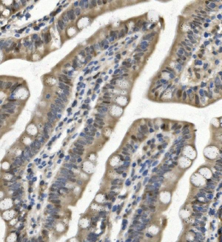 Anti-SAMHD1 Antibody