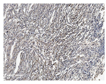 Anti-SHANK3 Antibody