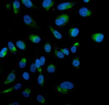 Anti-STK3/MST-2 Antibody