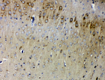 Anti-Synaptopodin/SYNPO Antibody