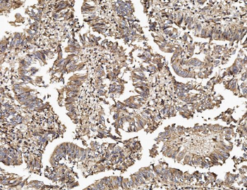Anti-TAB2 Antibody