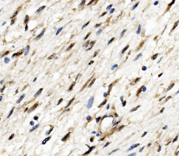 Anti-ETF/TEAD2 Antibody