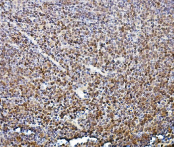 Anti-ETF/TEAD2 Antibody