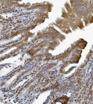 Anti-ETF/TEAD2 Antibody