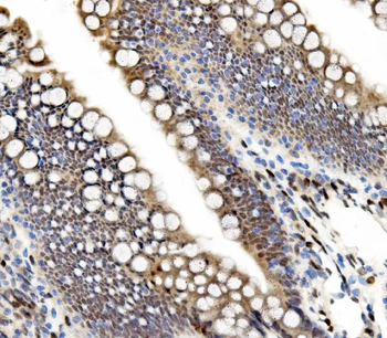 Anti-ETF/TEAD2 Antibody