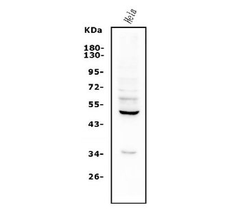 Anti-ETF/TEAD2 Antibody