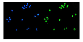Anti-TET1 Antibody