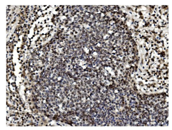 Anti-TET1 Antibody