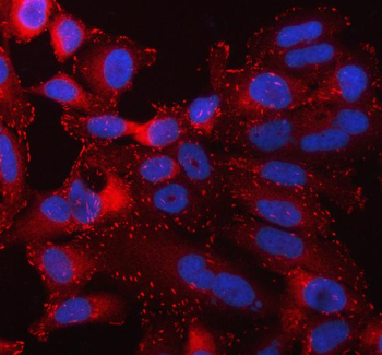Anti-Talin 1/TLN1 Antibody