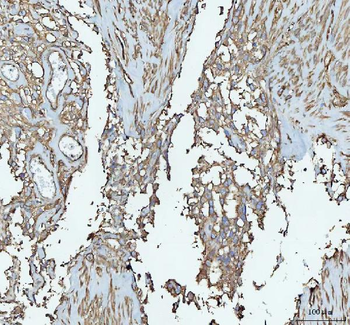 Anti-Talin 1/TLN1 Antibody