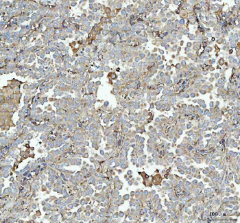 Anti-Talin 1/TLN1 Antibody