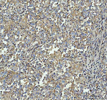 Anti-Talin 1/TLN1 Antibody