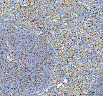 Anti-Talin 1/TLN1 Antibody