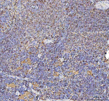 Anti-Talin 1/TLN1 Antibody