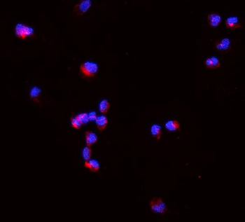 TNF alpha Antibody