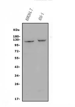 Anti-CD30/TNFRSF8 Antibody