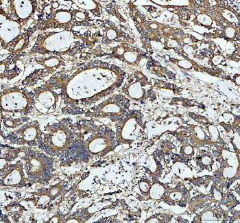 Anti-Tubulin beta Antibody