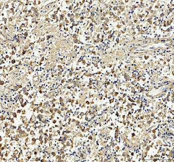 Anti-Tubulin beta Antibody