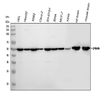 Anti-Tubulin beta Antibody