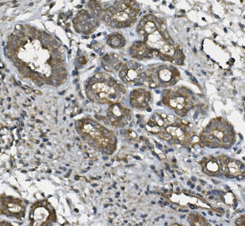 Anti-ULBP1 Antibody