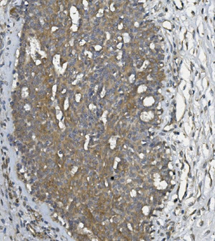 Anti-ULBP1 Antibody
