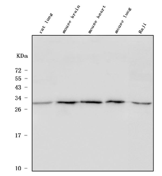 Anti-ULBP1 Antibody