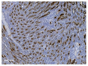 Anti-UMOD Antibody