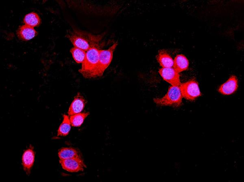 Anti-UNG Antibody