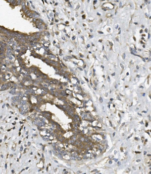 Anti-UNG Antibody
