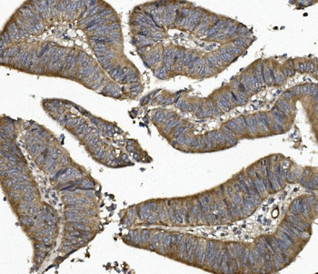 Anti-UNG Antibody