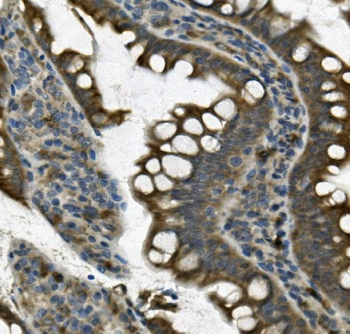 Anti-UNG Antibody