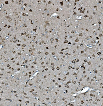 Anti-YWHAE Antibody