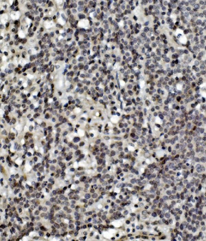 Anti-MCPIP1/ZC3H12A Antibody