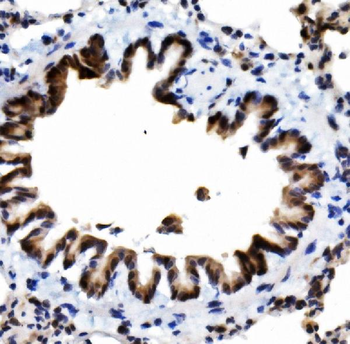 Anti-MCPIP1/ZC3H12A Antibody