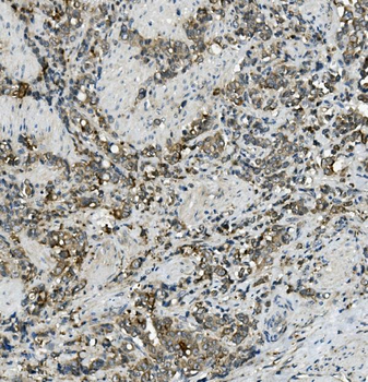 Anti-MRP5/ABCC5 Antibody