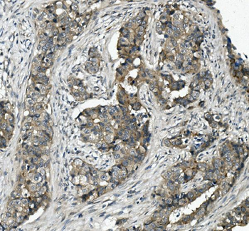Anti-MRP5/ABCC5 Antibody