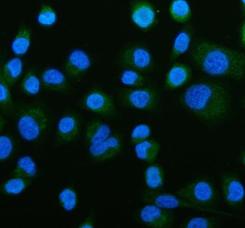 Anti-ACADS/SCAD Antibody