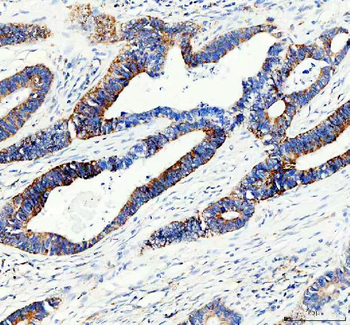 Anti-ACADS/SCAD Antibody
