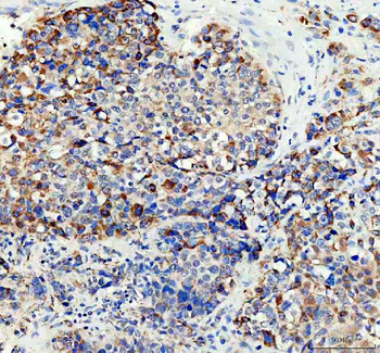 Anti-ACADS/SCAD Antibody
