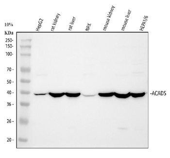 Anti-ACADS/SCAD Antibody