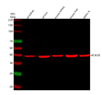 Anti-ACADS/SCAD Antibody