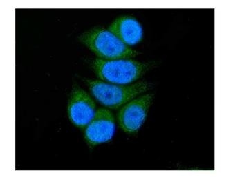 Anti-SBCAD/ACADSB Antibody