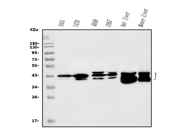 Anti-SBCAD/ACADSB Antibody