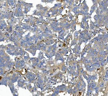 Anti-AFM Antibody