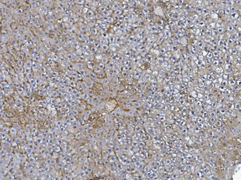 Anti-Afm Antibody