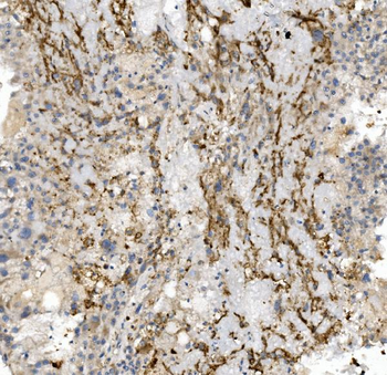 Anti-CCR2 Antibody